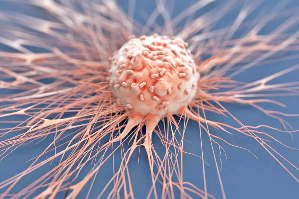 راه حل جدید محققان ایرانی برای درمان مؤثر تومورهای سرطانی