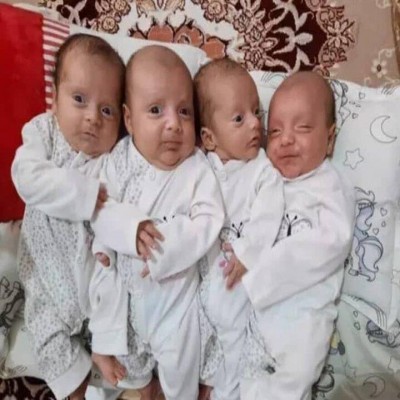 حمایت بهزیستی همدان از 810 خانوار دارای فرزند چندقلو